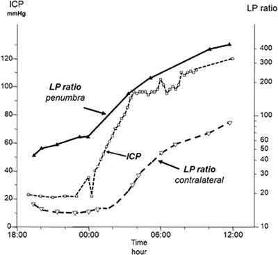 Bedside interpretation of cerebral energy metabolism utilizing microdialysis in neurosurgical and general intensive care